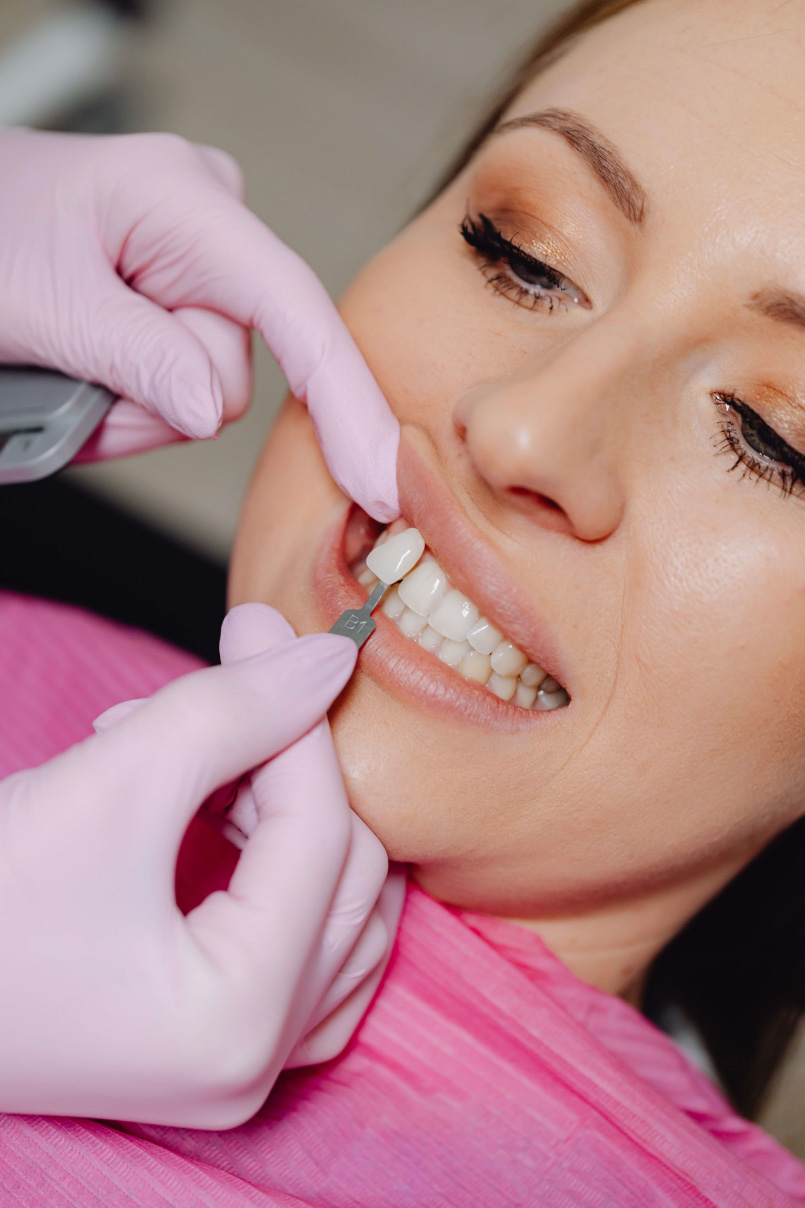 Clareamento Dental
